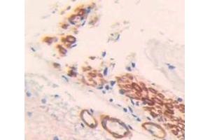 Immunohistochemistry (IHC) image for anti-Transmembrane Protein with EGF-Like and Two Follistatin-Like Domains 1 (TMEFF1) (AA 58-312) antibody (ABIN5014418)