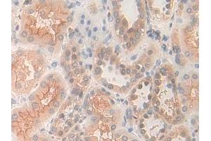 Detection of PDXK in Human Kidney Tissue using Polyclonal Antibody to Pyridoxal Kinase (PDXK)