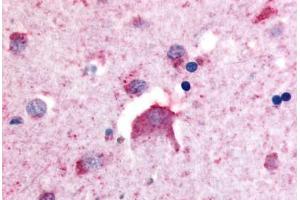 Anti-DPP6 antibody  ABIN1048510 IHC staining of human brain, neurons. (DPP6 抗体  (Internal Region))
