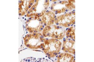 Immunohistochemical analysis of paraffin-embedded H. (BCL10 抗体  (AA 1-143))