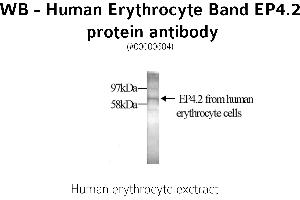 Image no. 1 for anti-erythrocyte Membrane Protein Band 4.2 (EPB42) antibody (ABIN346968) (EPB42 抗体)