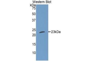 Western blot analysis of the recombinant protein. (Cardiotrophin 1 抗体  (AA 1-201))
