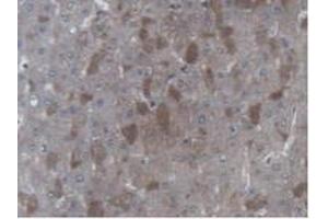 Detection of UBE2L3 in Human Liver Tissue using Polyclonal Antibody to Ubiquitin Conjugating Enzyme E2L3 (UBE2L3) (UBE2L3 抗体  (AA 4-154))
