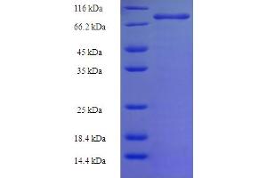 SDS-PAGE (SDS) image for Phosphoinositide-3-Kinase, Regulatory Subunit 5 (PIK3R5) (AA 1-494) protein (His-SUMO Tag) (ABIN5711599)