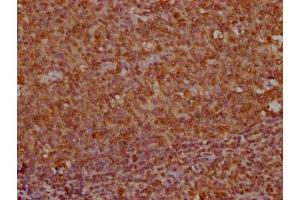 IHC image of ABIN7163895 diluted at 1:100 and staining in paraffin-embedded human tonsil tissue performed on a Leica BondTM system. (Ubiquitin B 抗体  (AA 103-228))