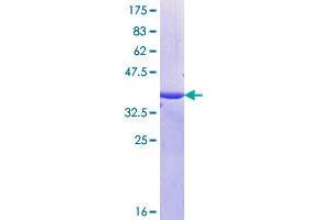 Mucin 16, Cell Surface Associated (CA125) (AA 1321-1415) protein (GST tag)