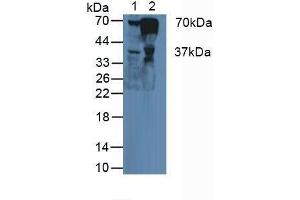 Western blot analysis of (1) Human Liver Tissue and (2) Human Blood Cells. (FGA 抗体  (AA 124-214))