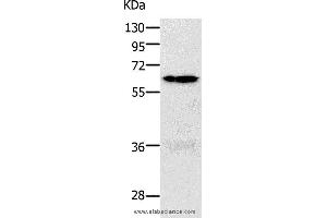 Western blot analysis of 293T and K562 cell, using PAK1 Polyclonal Antibody at dilution of 1:700 (PAK1 抗体)