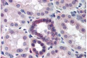 Human Kidney (formalin-fixed, paraffin-embedded) stained with CAND2 antibody ABIN218497 at 1:500 followed by biotinylated goat anti-rabbit IgG secondary antibody ABIN481713, alkaline phosphatase-streptavidin and chromogen. (CAND2 抗体  (C-Term))