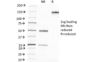 SDS-PAGE Analysis Purified PSA Mouse Monoclonal Antibody (A67-B/E3). (Prostate Specific Antigen 抗体)