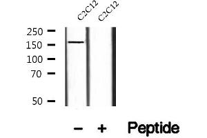 Western blot analysis of extracts of C2C12 cells, using Phospho-TBC1D1 (Thr590) Antibody.