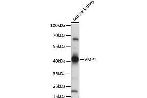 Western blot analysis of extracts of mouse kidney, using VMP1 antibody (ABIN7271283) at 1:1000 dilution. (VMP1 抗体  (C-Term))