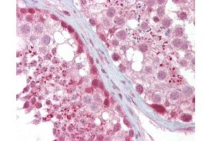 Anti-IFT88 antibody IHC of human testis. (IFT88 抗体  (AA 721-770))