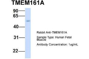 Host:  Rabbit  Target Name:  TMEM161A  Sample Type:  Human Fetal Muscle  Antibody Dilution:  1. (TMEM161A 抗体  (Middle Region))