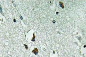 Immunohistochemistry (IHC) analyzes of PAH antibody in paraffin-embedded human brain tissue. (Phenylalanine Hydroxylase 抗体)