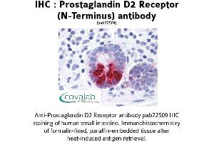 Image no. 1 for anti-Prostaglandin D2 Receptor (PTGDR) (Extracellular Domain), (N-Term) antibody (ABIN1738422)
