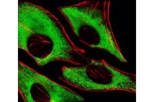 Fluorescent image of HeLa cells stained with RPS6 antibody at 1:25 dilution. (RPS6 抗体)