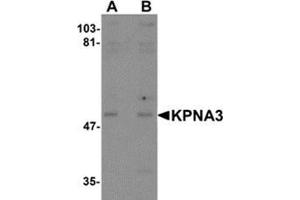 Western blot analysis of KPNA3 in EL4 cell lysate with KPNA3 antibody at (A) 1 and (B) 2 μg/ml. (KPNA3 抗体  (C-Term))