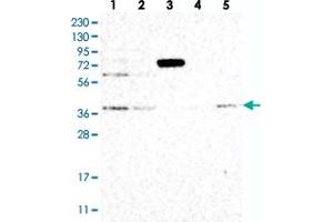 Western blot analysis of Lane 1: RT-4, Lane 2: U-251 MG, Lane 3: Human Plasma, Lane 4: Liver, Lane 5: Tonsil with STRAP polyclonal antibody  at 1:250-1:500 dilution. (STRAP 抗体)