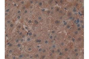 Detection of ADCY3 in Human Liver Tissue using Polyclonal Antibody to Adenylate Cyclase 3 (ADCY3) (ADCY3 抗体  (AA 501-736))
