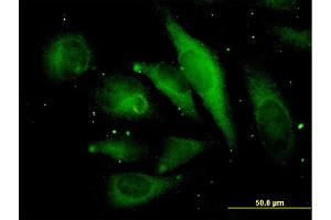 Immunofluorescence of monoclonal antibody to MAPRE2 on HeLa cell. (MAPRE2 抗体  (AA 1-62))