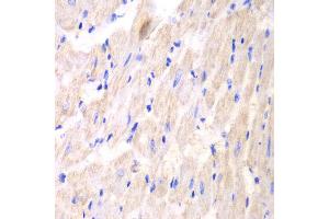 Immunohistochemistry of paraffin-embedded mouse heart using YWHAQ antibody at dilution of 1:100 (400x lens). (14-3-3 theta 抗体)
