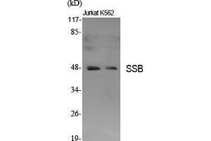 Western Blot (WB) analysis of specific cells using SSB Polyclonal Antibody. (SSB 抗体  (Ser366))