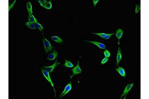 Immunofluorescent analysis of Hela cells using ABIN7152398 at dilution of 1:100 and Alexa Fluor 488-congugated AffiniPure Goat Anti-Rabbit IgG(H+L) (FBXL22 抗体  (AA 123-229))