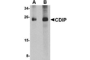 Western blot analysis of CDIP in human brain lysate with AP30219PU-N CDIP antibody at (A) 1 and (B) 2 μg/ml. (CDIP1 抗体  (Center))