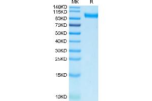 Biotinylated Human Axl on Tris-Bis PAGE under reduced condition. (AXL Protein (AA 26-449) (Fc Tag,Biotin))