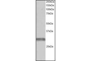 Antibody staining (1 µg/ml) of Human Muscle lysate (RIPA buffer, 30 µg total protein per lane). (TRIM7 抗体  (C-Term))