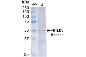Western blot analysis of Human Cervical cancer cell line (HeLa) lysate showing detection of ~51 kDa Beclin 1 protein using Rabbit Anti-Beclin 1 Polyclonal Antibody (ABIN2868740). (Beclin 1 抗体  (Atto 390))