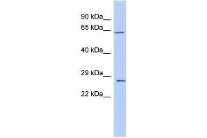 WB Suggested Anti-CLDN18 Antibody Titration:  0.