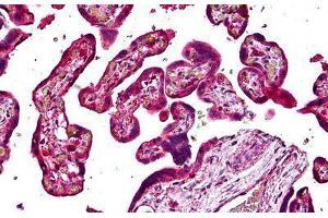 Human Placenta: Formalin-Fixed, Paraffin-Embedded (FFPE) (Sorting Nexin 4 抗体  (AA 438-450))