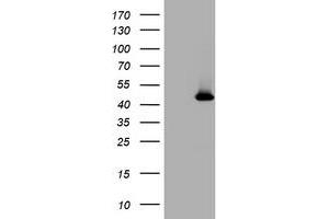 Image no. 1 for anti-Melanoma Antigen Family A, 4 (MAGEA4) antibody (ABIN1499261) (MAGEA4 抗体)