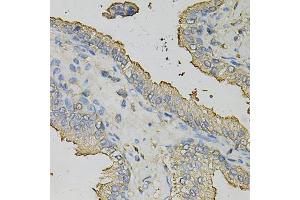 Immunohistochemistry of paraffin-embedded human prostate using AZGP1 Antibody (ABIN5973101) at dilution of 1/100 (40x lens). (AZGP1 抗体)