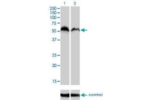 Western blot analysis of NRF1 over-expressed 293 cell line, cotransfected with NRF1 Validated Chimera RNAi (Lane 2) or non-transfected control (Lane 1). (NRF1 抗体  (AA 201-285))