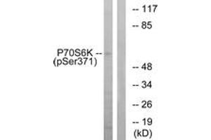 Western blot analysis of extracts from COLO205 cells treated with serum 20% 15', using p70 S6 Kinase (Phospho-Ser371) Antibody.