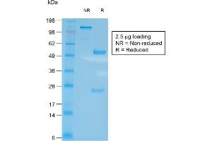 SDS-PAGE Analysis of Purified CD27 Rabbit Recombinant Monoclonal Antibody (LPFS2/2034R). (Recombinant CD27 抗体)
