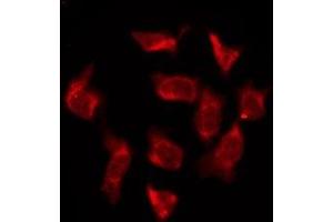 ABIN6276184 staining HeLa by IF/ICC. (OR6T1 抗体  (C-Term))