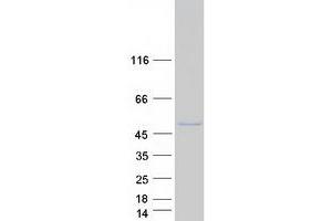 Western Blotting (WB) image for Single Stranded DNA Binding Protein 3 (SSBP3) (Transcript Variant 1) protein (Myc-DYKDDDDK Tag) (ABIN2732693)