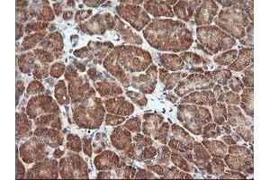 Image no. 4 for anti-Mitogen-Activated Protein Kinase Kinase 1 (MAP2K1) antibody (ABIN1499388) (MEK1 抗体)