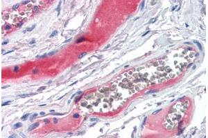 Human Small Intestine, Vessels (formalin-fixed, paraffin-embedded) stained with KLKB1 antibody ABIN351494 at 5 ug/ml followed by biotinylated secondary antibody, alkaline phosphatase-streptavidin and chromogen. (KLKB1 抗体)
