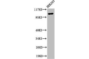 Western Blot analysis of 293 cells using RoXaN Polyclonal Antibody (ZC3H7B 抗体  (C-Term))