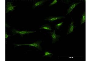 Immunofluorescence of monoclonal antibody to CTNND2 on HeLa cell. (CTNND2 抗体  (AA 1081-1190))