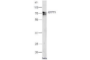 Human HeLa lysates probed with Rabbit Anti-GFPT1 Polyclonal Antibody, Unconjugated (ABIN1714093) at 1:300 overnight at 4˚C. (GFPT1 抗体  (AA 601-699))