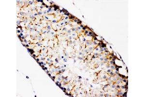 IHC-P: TBK1 antibody testing of rat testis tissue.