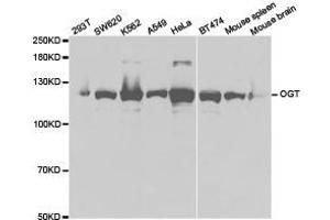 Western Blotting (WB) image for anti-O-Linked N-Acetylglucosamine (GlcNAc) Transferase (UDP-N-Acetylglucosamine:polypeptide-N-Acetylglucosaminyl Transferase) (OGT) antibody (ABIN1874000) (OGT 抗体)