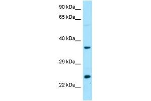 WB Suggested Anti-DTD1 Antibody Titration: 1. (DTD1 抗体  (C-Term))