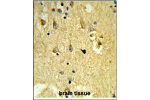 Immunohistochemistry (Paraffin-embedded Sections) (IHC (p)) image for anti-SH3 Domain Binding Glutamic Acid-Rich Protein Like 3 (SH3BGRL3) (AA 31-60), (Middle Region) antibody (ABIN954790)
